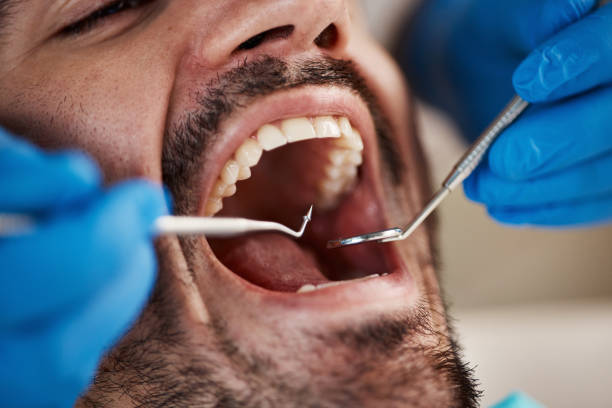 Best Emergency Dental Care for Sports Injuries in Whitaker, PA