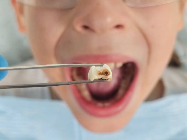 Best Emergency Treatment for Oral Infections in Whitaker, PA